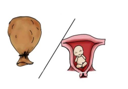 无锡试管婴儿价格：移植后三天腹痛和着床没关系，及时解决才最重要